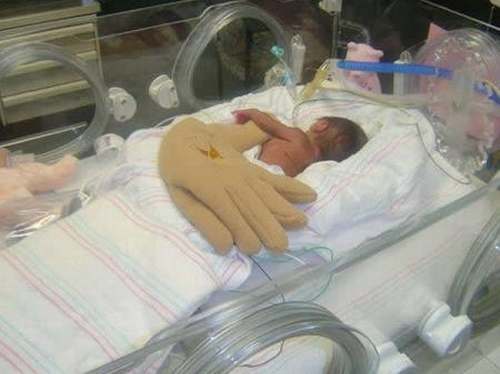 Vemos al bebe en la incubadora duerme cubierto por la almohada gigante en forma de mano