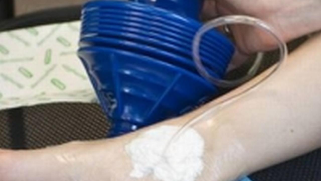 Desarrollan dispositivo que acelera la curación de las heridas por $3 dólares