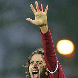 Vemos un futbolista que celebra un gol feliz y muestra despues su dedo desgarrado