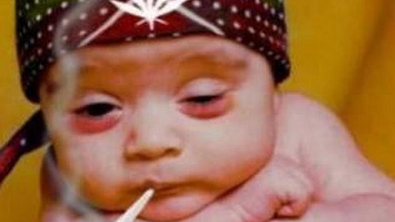 Bebé intoxicado con marihuana en Israel