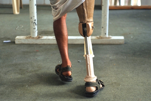 Un hombre con una prótesis en una pierna avanza  tratando de caminar