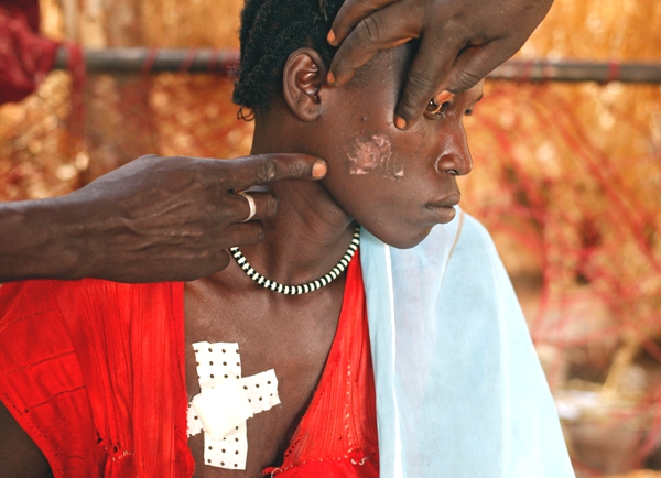 Una mujer con heridas en su rostro y un vendaje en su cuello mientras otra persona trata de hacerle una curacion
