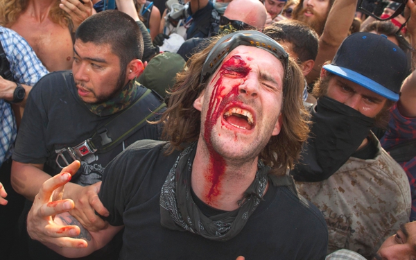 Miramos a un hombre que sangra sobre su ojo derecho y cae la sangre subre su rostro hasta el cuello en una protesta varias personas están a su lado